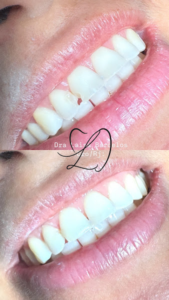 Foto 3 de Dra. Laisa Barcelos l Dentista Alcântara