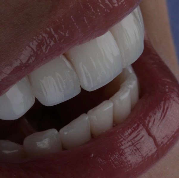 Foto 2 de Dra. Laísa Botto | Ortodontista e Odontologia Estética