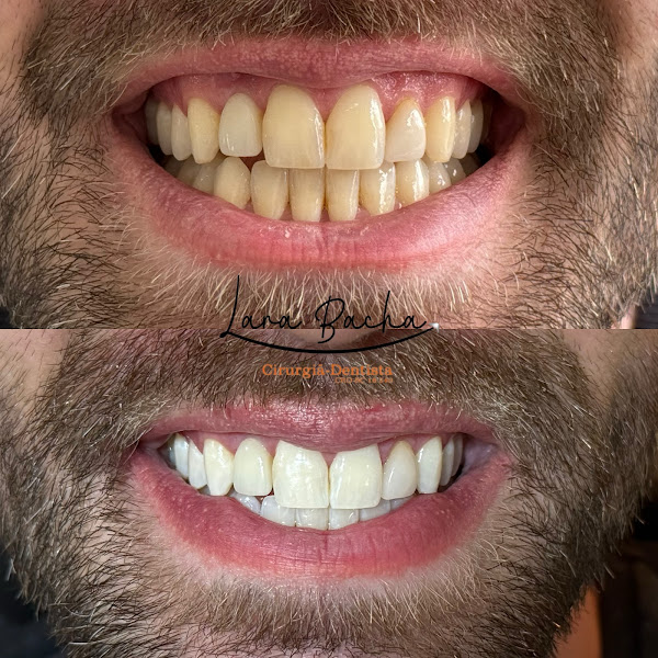 Foto 2 de Dra. Lara Bacha Cirurgiã-Dentista