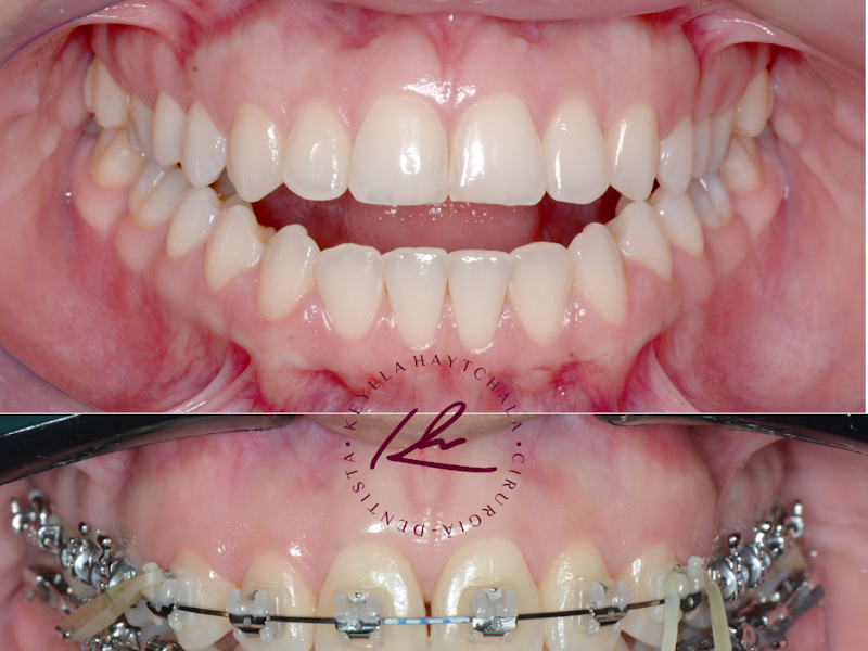 Foto 4 de Dra. Lara Diniz - Cirurgiã Dentista