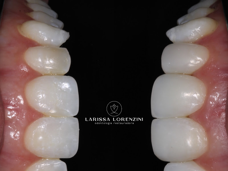 Foto 7 de Dra Lara Laís Monezi