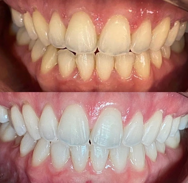 Foto de Dra. Lara Rosário - Periodontista Alagoinhas