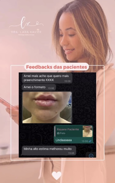 Foto 3 de Dra. Lara Xavier | Odontologia e Harmonização Orofacial