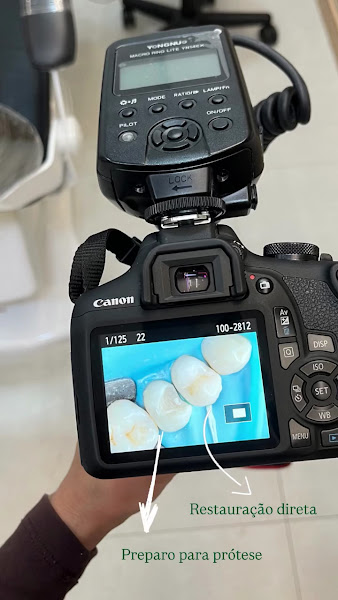 Foto 2 de Dra. Larissa Araújo | Dentista Bela Vista | Facetas em resina | Facetas em porcelana