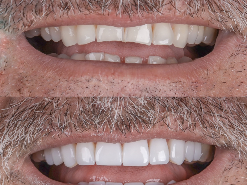 Foto 3 de Dra Larissa F. Soares Pinto - Dentista especialista em Endodontia