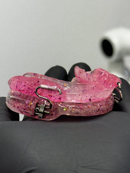 Foto 3 de Dra Larissa Gimenez - Ortodontia e Aparelho do Ronco