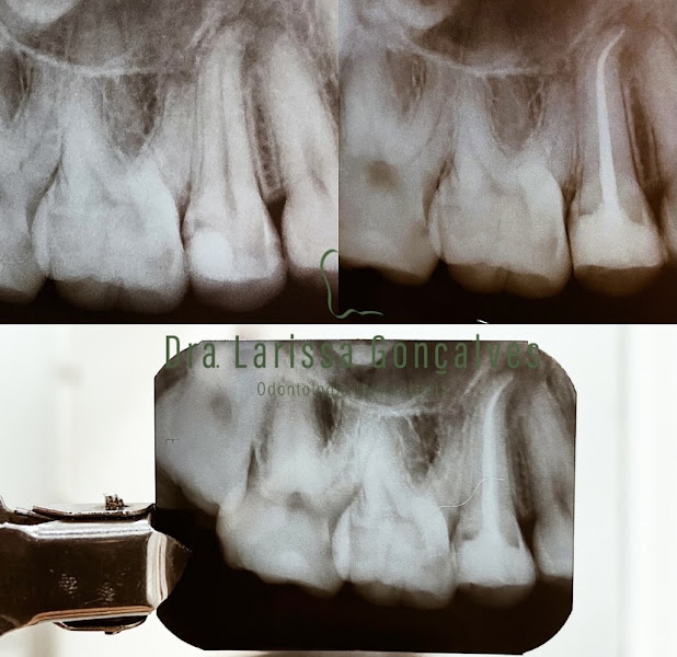 Foto 2 de Dra. Larissa Gonçalves - Cirurgiã-dentista
