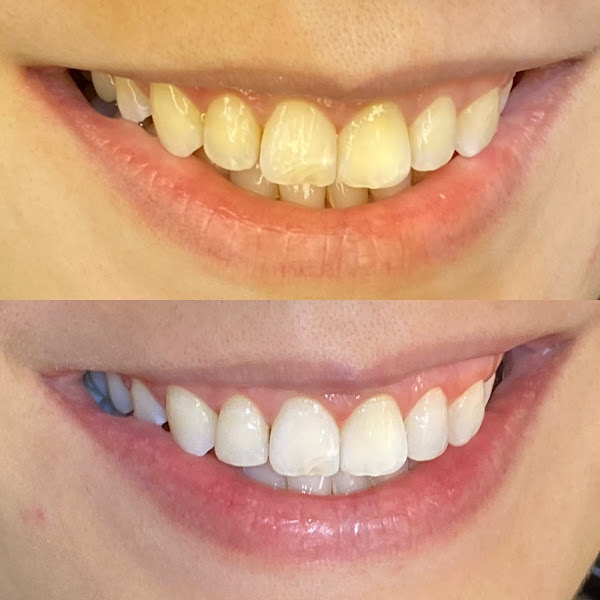 Foto 3 de Dra. Larissa Ketelen | Odontologia estética personalizada