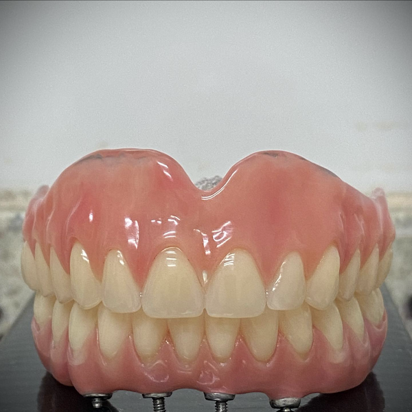 Foto 3 de Dra. Larissa Lisboa | Implantes e Reabilitação Oral