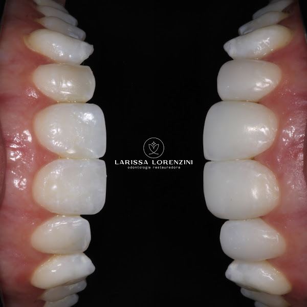 Foto 2 de Dra Larissa Lorenzini - Odontologia Restauradora