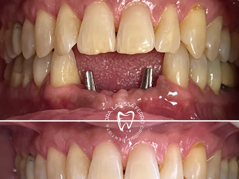Foto 6 de Dra Larissa Lorenzini - Odontologia Restauradora