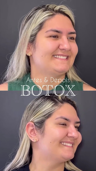 Foto 3 de Dra. Larissa Maria | Dentista