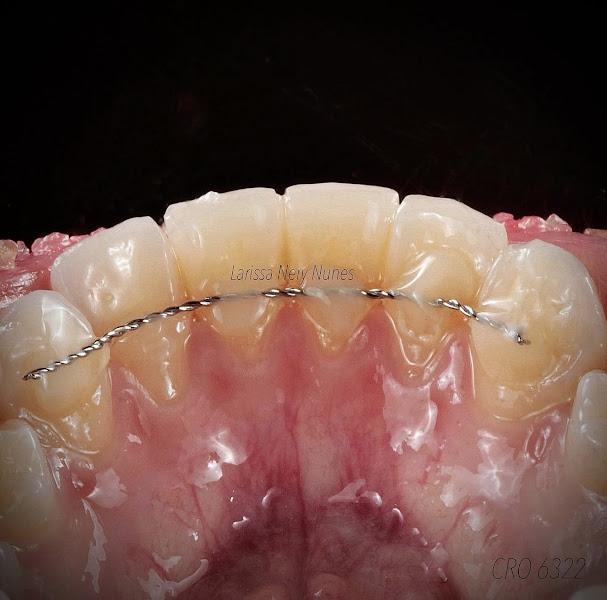 Foto 3 de Dra. Larissa Nery Nunes Dentista