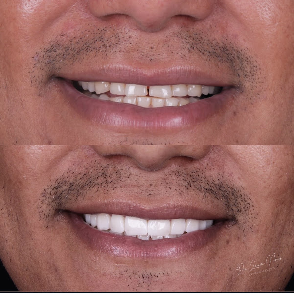 Foto 3 de Dra Larissa Neves