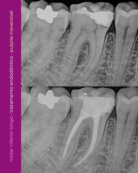 Foto 2 de Dra. Larissa Oliveira- Endodontia Microscópica/Urgência