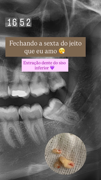 Foto 3 de Dra Larissa Pauletti - Dentista Sorocaba