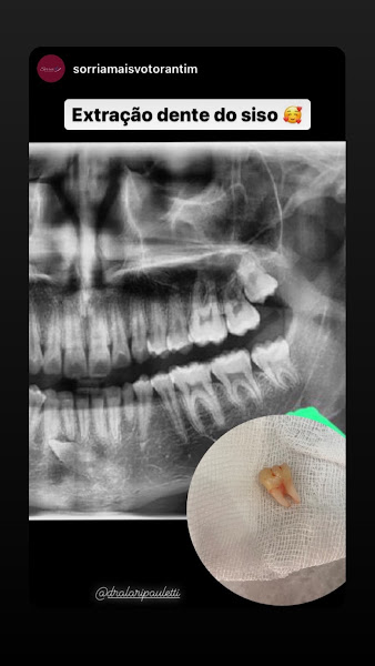 Foto 6 de Dra Larissa Pauletti - Dentista Sorocaba