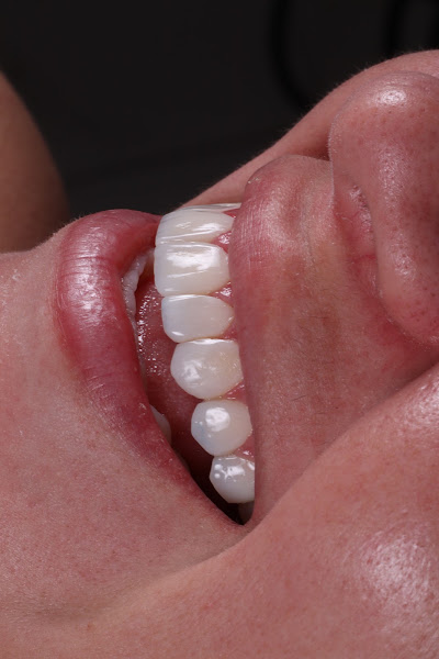 Foto 2 de Dra. Larissa Silva - Odontologia Estética