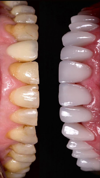 Foto 3 de Dra. Larissa Silva - Odontologia Estética