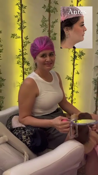 Foto 3 de Dra. Larissa Tapia | Harmonização Facial Em Campinas