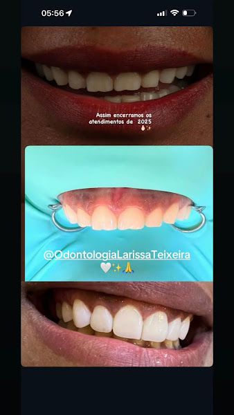 Foto 3 de Dra. Larissa Teixeira