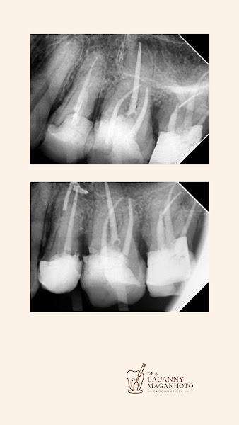 Foto 2 de Dra. Lauanny Maganhoto - Endodontista em Americana (SP)