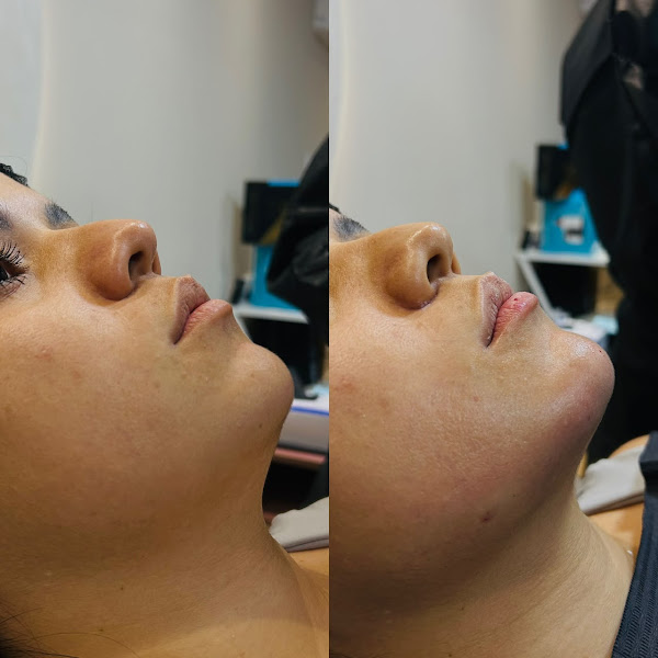 Foto 2 de Dra. Lauany Fernandes - Odontologia estética e harmonização facial Recife