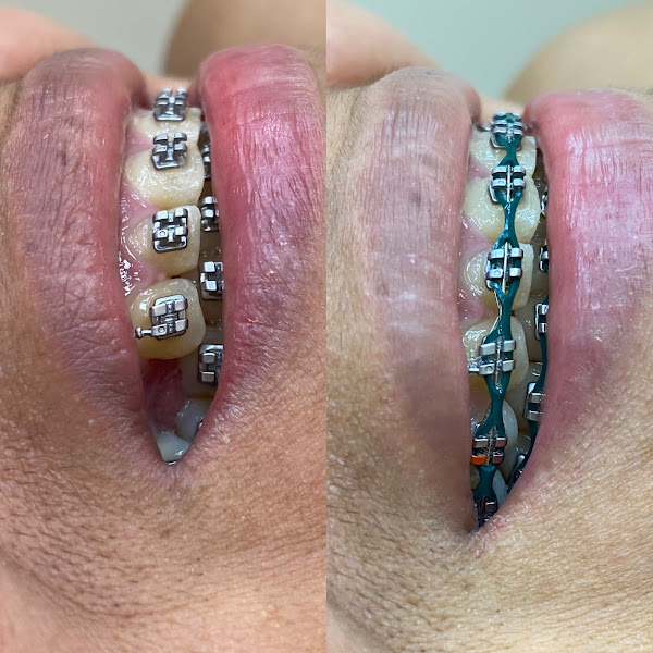 Foto 2 de Dra. Laudyanne Souza - Dentista - Consultório Odontológico