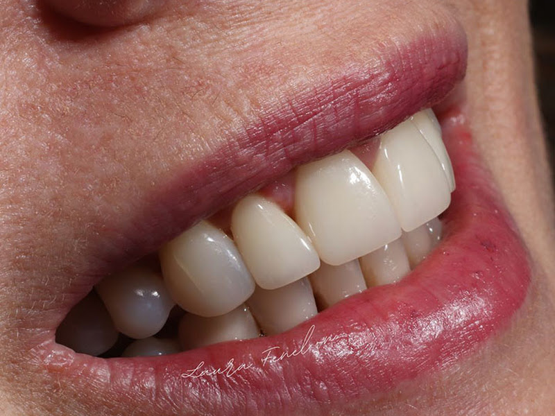 Foto 3 de Dra. Laura Fenelon, Dentista