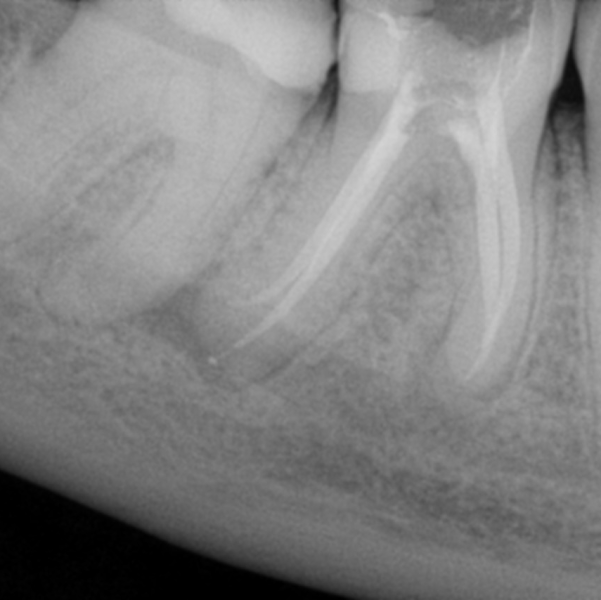 Foto 3 de Dra. Laura Pintado | Prótese dentária e Reabilitação oral