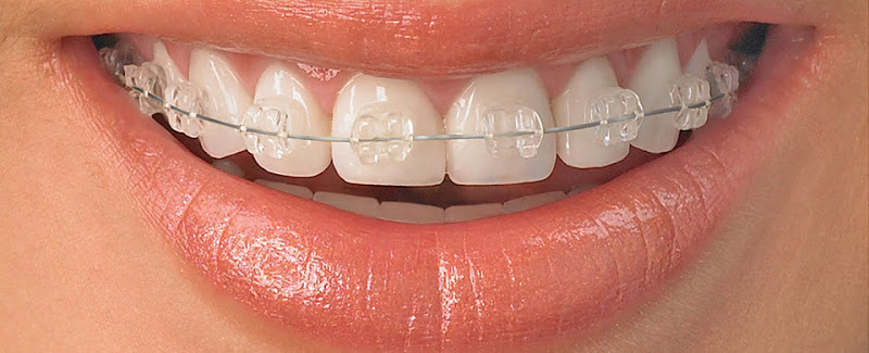 Foto 2 de Dra Laura Zanini