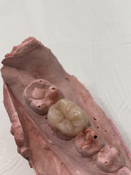 Foto 2 de Dra. Lauren Rossarola - Odontologia e Reabilitação Oral