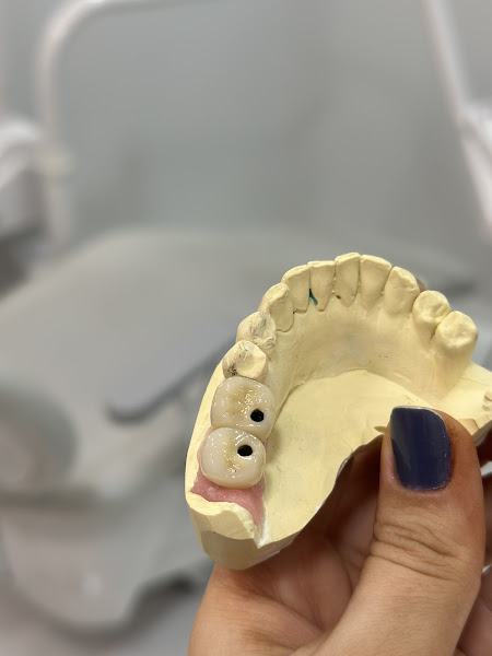 Foto 3 de Dra. Lauren Rossarola - Odontologia e Reabilitação Oral