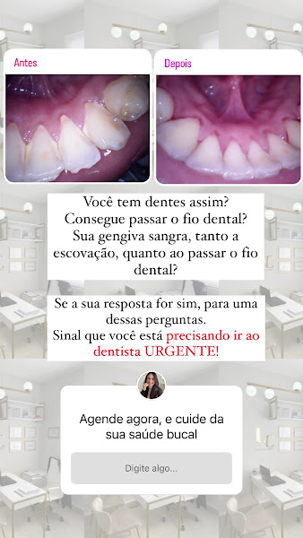 Foto 3 de Dra. Layla Corrêa - Mooca ,SP - Clareamento Dental, Lentes em Resina, Ortodontia, Limpeza, Botox, Preenchimento labial