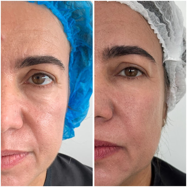 Foto 3 de Dra. Leila Fidelis - Harmonização Facial