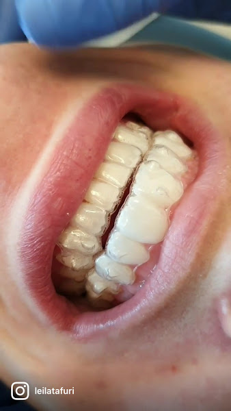 Foto 3 de Dra. Leila Tafuri - Ortodontia e Alinhadores