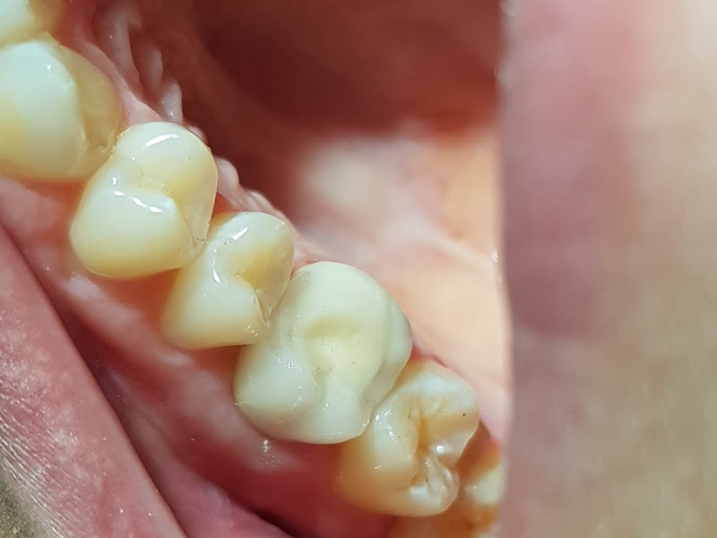 Foto 3 de Dra Leilane Laranjeira