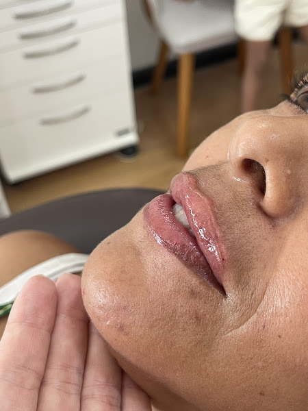 Foto 3 de Dra Letícia Alves - Harmonização Facial