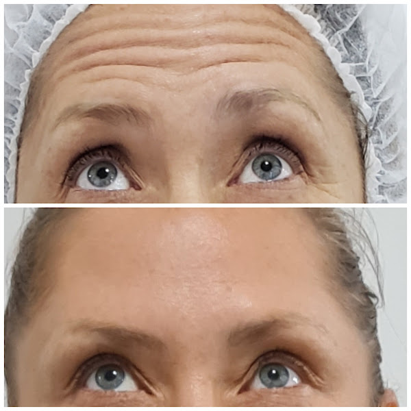 Foto 3 de Dra. Letícia Andriotti - Harmonização Facial e Preenchimento Labial.