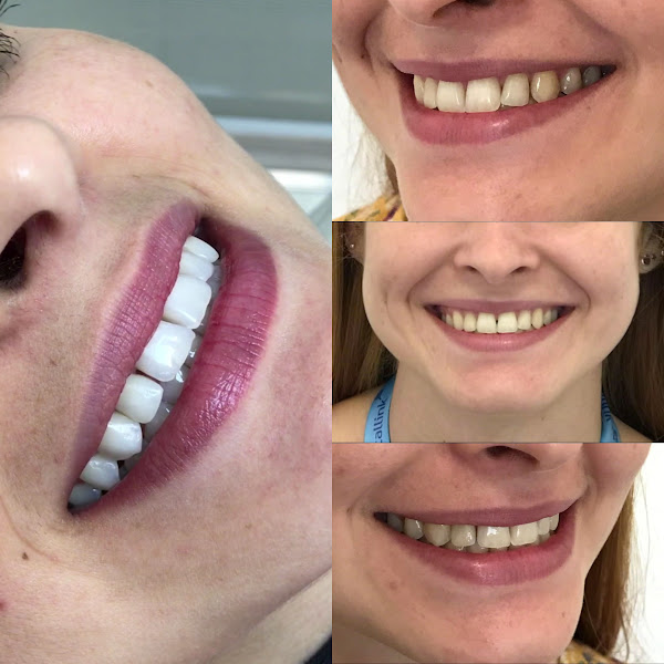 Foto 3 de Dra. Letícia B. Qualhato - Dentista em Uberlândia