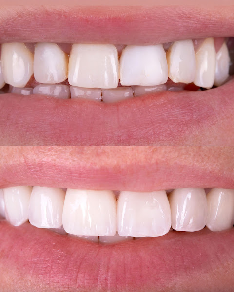 Foto 3 de Dra. Letícia Babeto | Dentista | Ortodontia e Harmonização Orofacial
