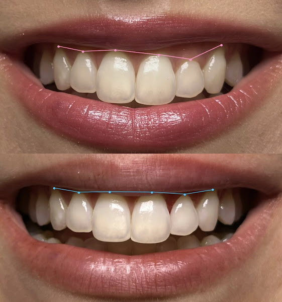 Foto 2 de Dra. Letícia Cortellini - Dentista em Londrina