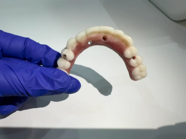 Foto 3 de Dra. Letícia - Dentista - Implante Dentário| prótese Dentária e Dentadura