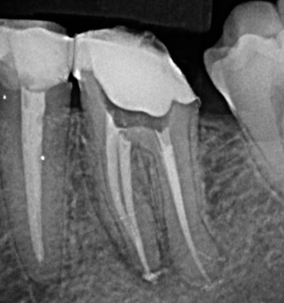 Foto 3 de Dra Letícia Dias - Tratamento de Canal