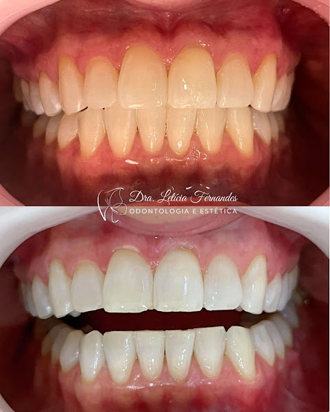 Foto 3 de Dra Leticia Fernandes - Cirurgiã Dentista