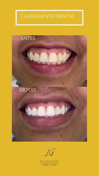 Foto 4 de Dra. Letícia Godoi l Preenchimento Facial, Botox, Harmonização, Bioestimulador de Colágeno em Araraquara