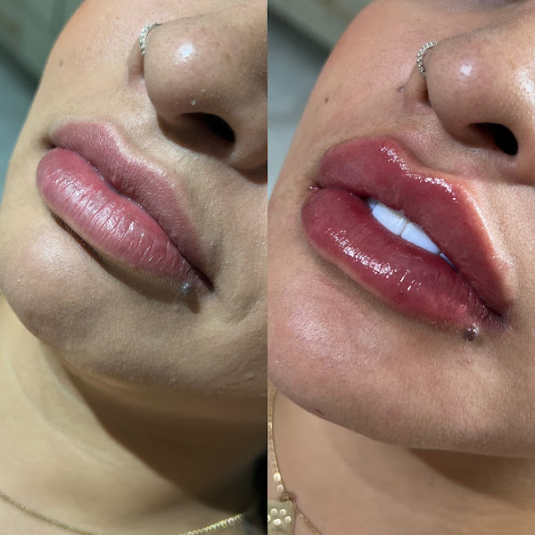 Foto 2 de Dra. Letícia Morais - Odontologia e Harmonização Orofacial