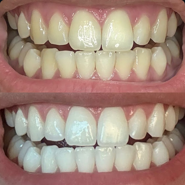 Foto 3 de Dra. Letícia Morais - Odontologia e Harmonização Orofacial