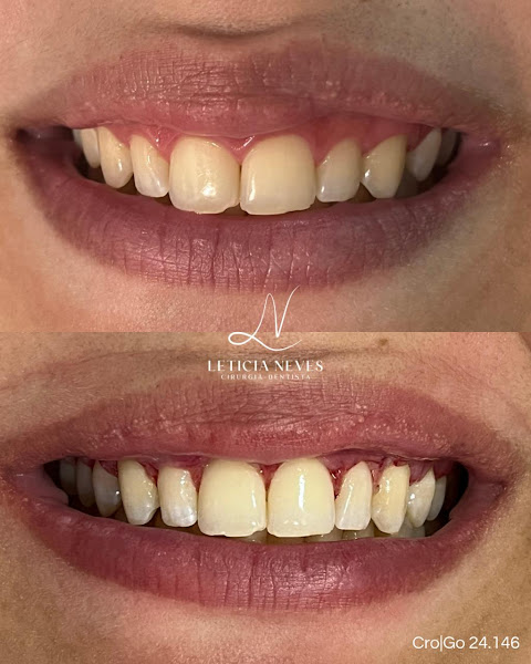 Foto 3 de Dra. Leticia Neves - Dentista