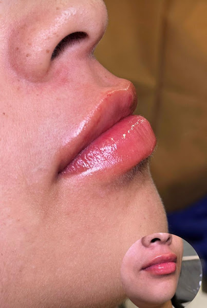 Foto 2 de Dra. Letícia Pacheco | Harmonização Facial e Estética Vila Mariana
